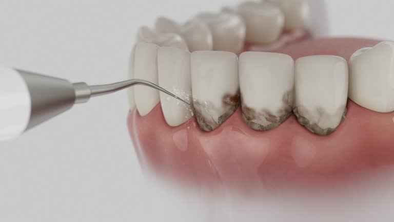 Trusted Teeth Cleaning And Checkup service in Eunice, NM - Dentist Open Now